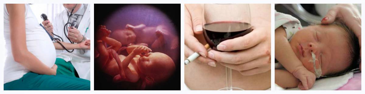 гемангиома: факторы риска