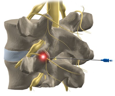 операция в Израиле