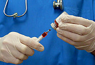 лечение астроцитомы химиотерапией